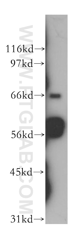 Western Blot (WB) analysis of HeLa cells using SHC Polyclonal antibody (12496-1-AP)