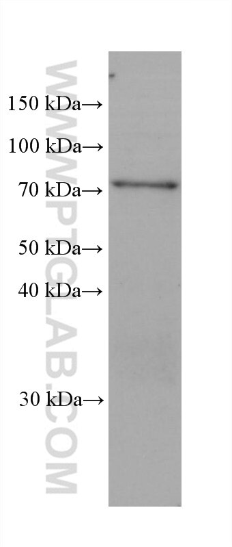 Western Blot (WB) analysis of hTERT-RPE1 cells using SHC1 Monoclonal antibody (67194-2-Ig)