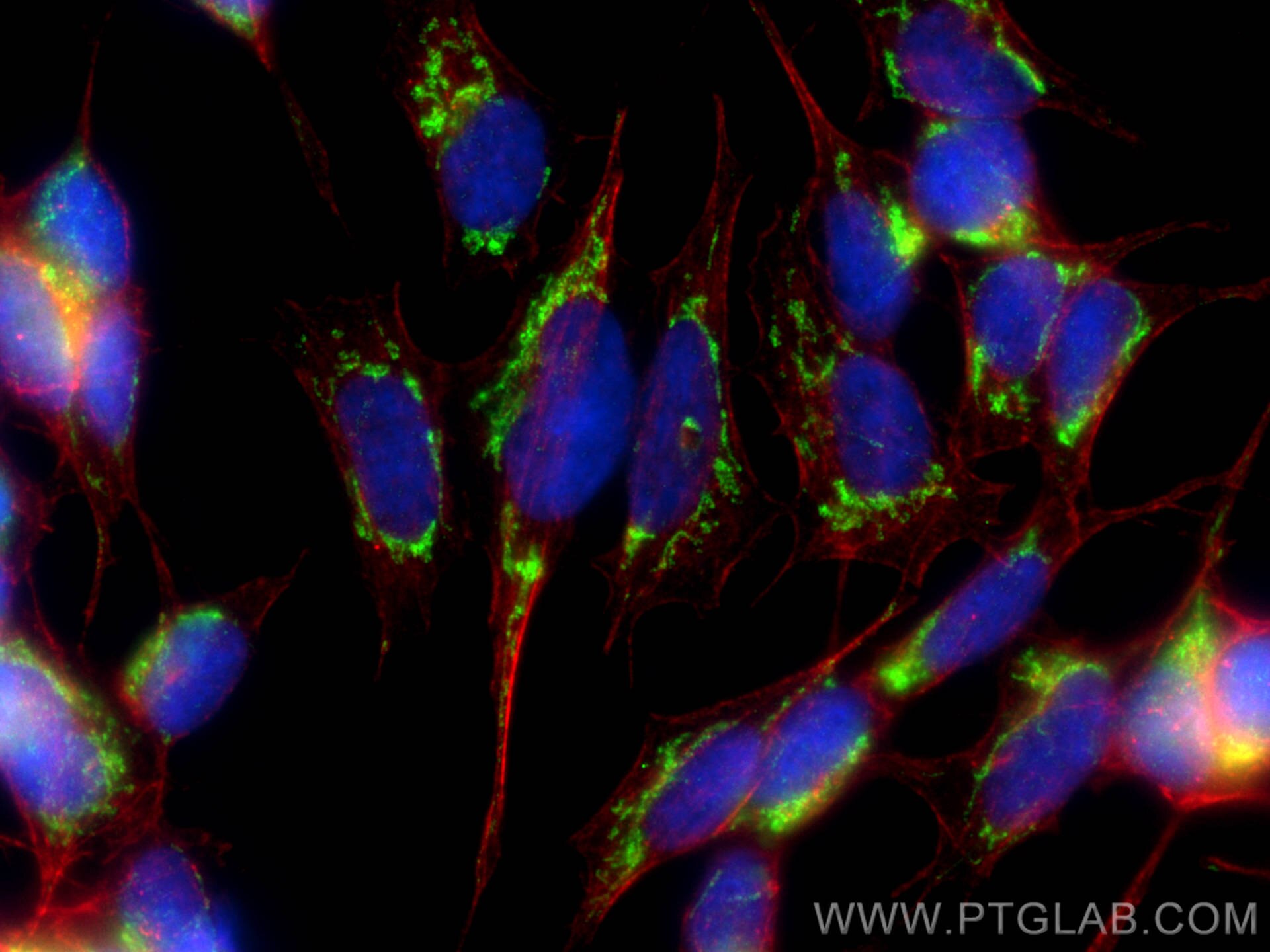 Immunofluorescence (IF) / fluorescent staining of SH-SY5Y cells using SHC4 Polyclonal antibody (12641-1-AP)