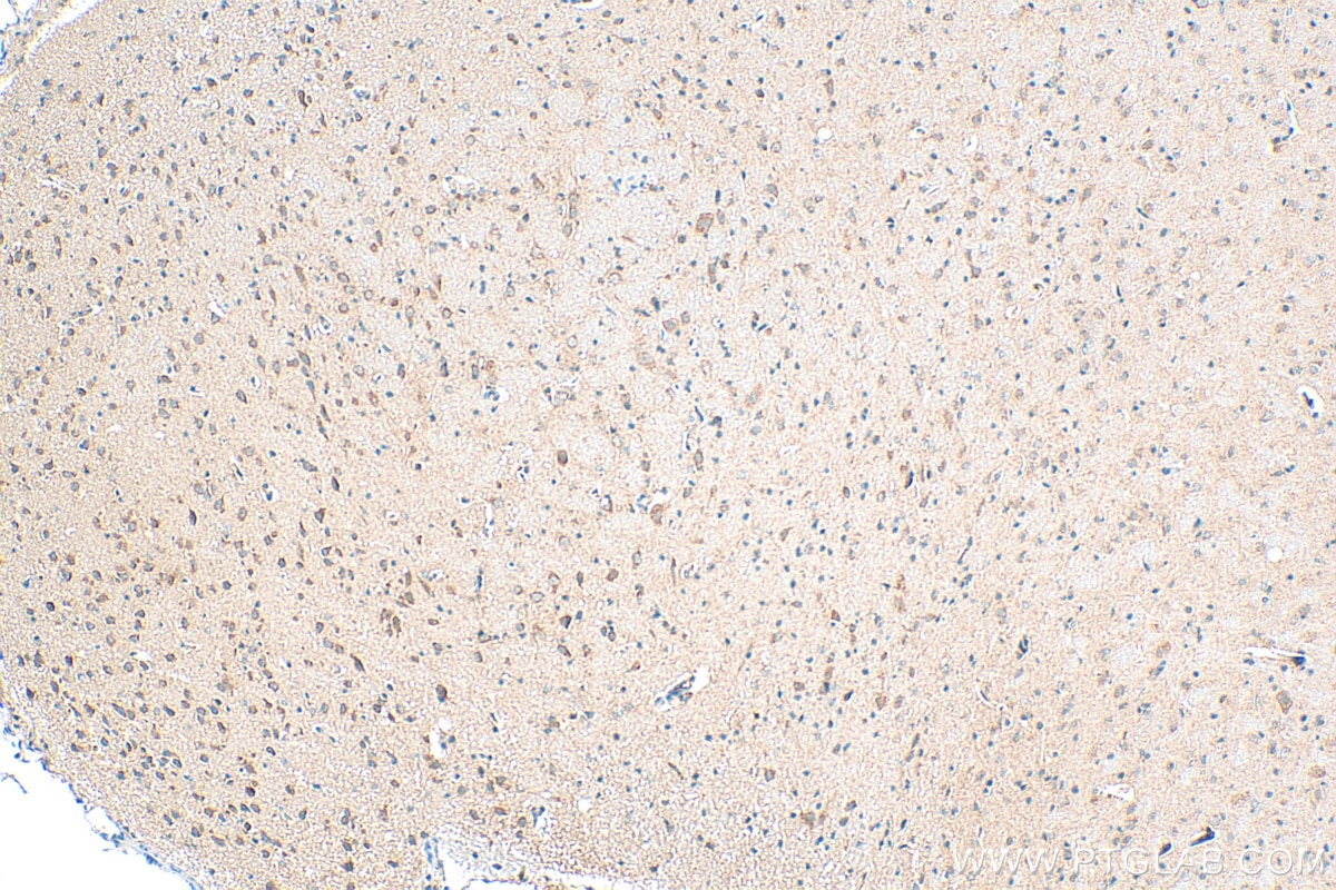 Immunohistochemistry (IHC) staining of rat brain tissue using SHC4 Polyclonal antibody (12641-1-AP)