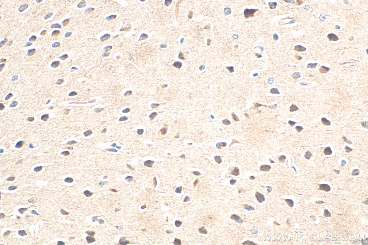 Immunohistochemistry (IHC) staining of mouse brain tissue using SHC4 Polyclonal antibody (12641-1-AP)
