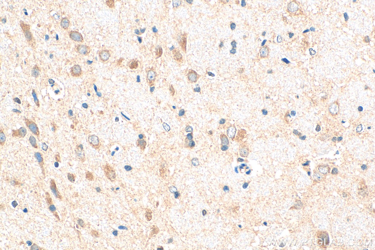 Immunohistochemistry (IHC) staining of rat brain tissue using SHC4 Polyclonal antibody (12641-1-AP)