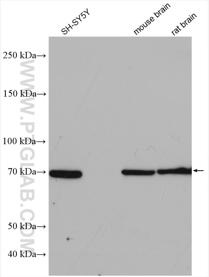 Western Blot (WB) analysis of various lysates using SHC4 Polyclonal antibody (12641-1-AP)