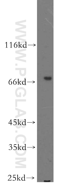 Western Blot (WB) analysis of human brain tissue using SHC4 Polyclonal antibody (12641-1-AP)