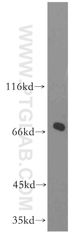 Western Blot (WB) analysis of human skeletal muscle tissue using SHC4 Polyclonal antibody (12641-1-AP)