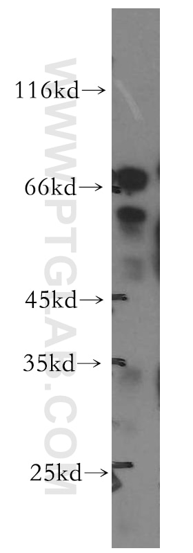 Western Blot (WB) analysis of A375 cells using SHC4 Polyclonal antibody (12641-1-AP)