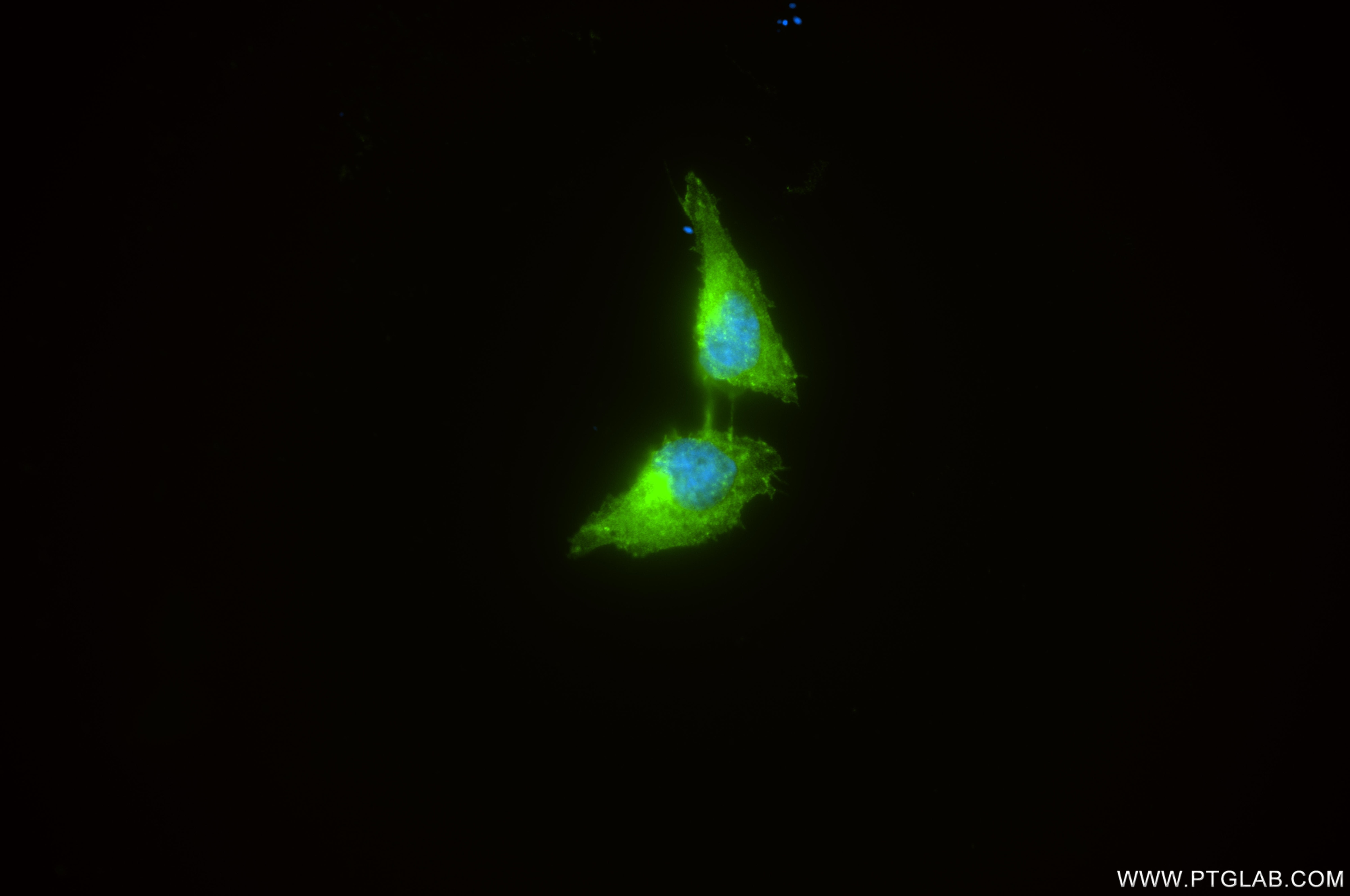 Immunofluorescent analysis of (4% PFA) fixed SH-SY5Y cells using SHC4 antibody (85181-4-RR, Clone: 242805E3 ) at dilution of 1:200 and CoraLite®488-Conjugated Goat Anti-Rabbit IgG(H+L) (SA00013-2). Immunofluorescence (IF) / fluorescent staining of SH-SY5Y cells using SHC4 Recombinant monoclonal antibody (85181-4-RR)
