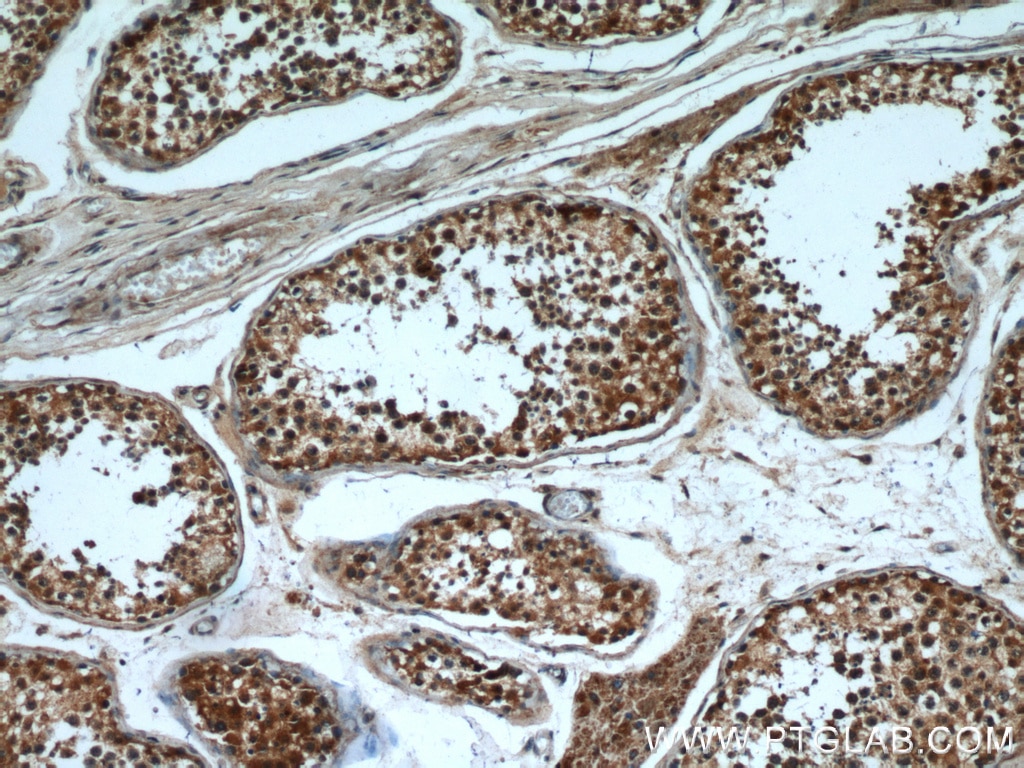 Immunohistochemistry (IHC) staining of human testis tissue using SHCBP1 Polyclonal antibody (12672-1-AP)