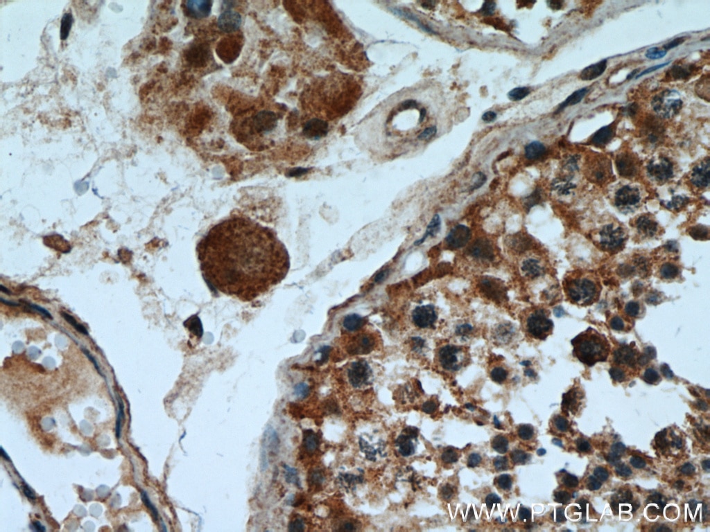 Immunohistochemistry (IHC) staining of human testis tissue using SHCBP1 Polyclonal antibody (12672-1-AP)