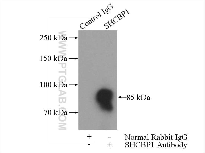 Immunoprecipitation (IP) experiment of Jurkat cells using SHCBP1 Polyclonal antibody (12672-1-AP)