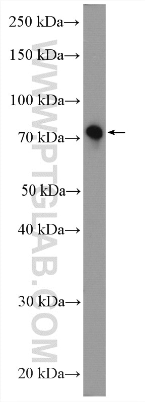 Western Blot (WB) analysis of Neuro-2a cells using SHCBP1 Polyclonal antibody (12672-1-AP)