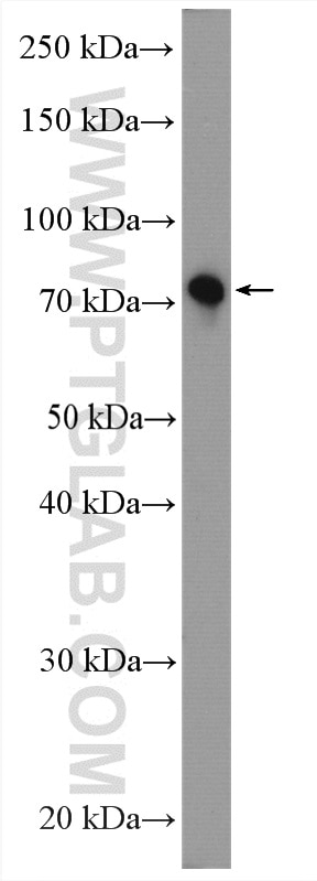 WB analysis of Neuro-2a using 12672-1-AP