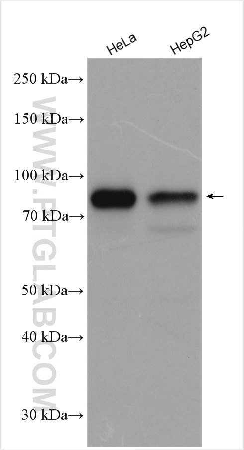 Western Blot (WB) analysis of various lysates using SHCBP1 Polyclonal antibody (12672-1-AP)