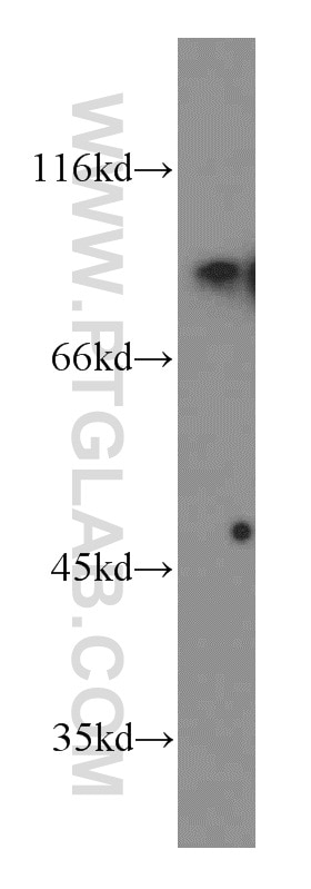 Western Blot (WB) analysis of Jurkat cells using SHCBP1 Polyclonal antibody (12672-1-AP)