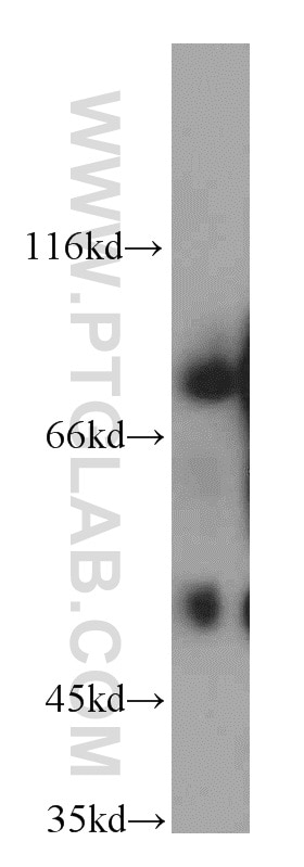 Western Blot (WB) analysis of Sp2/0 cells using SHCBP1 Polyclonal antibody (12672-1-AP)