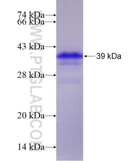 SHCBP1 fusion protein Ag17517 SDS-PAGE
