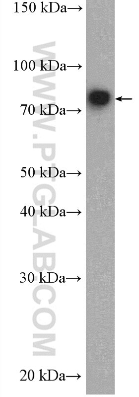 Western Blot (WB) analysis of mouse testis tissue using SHCBP1L Polyclonal antibody (27108-1-AP)