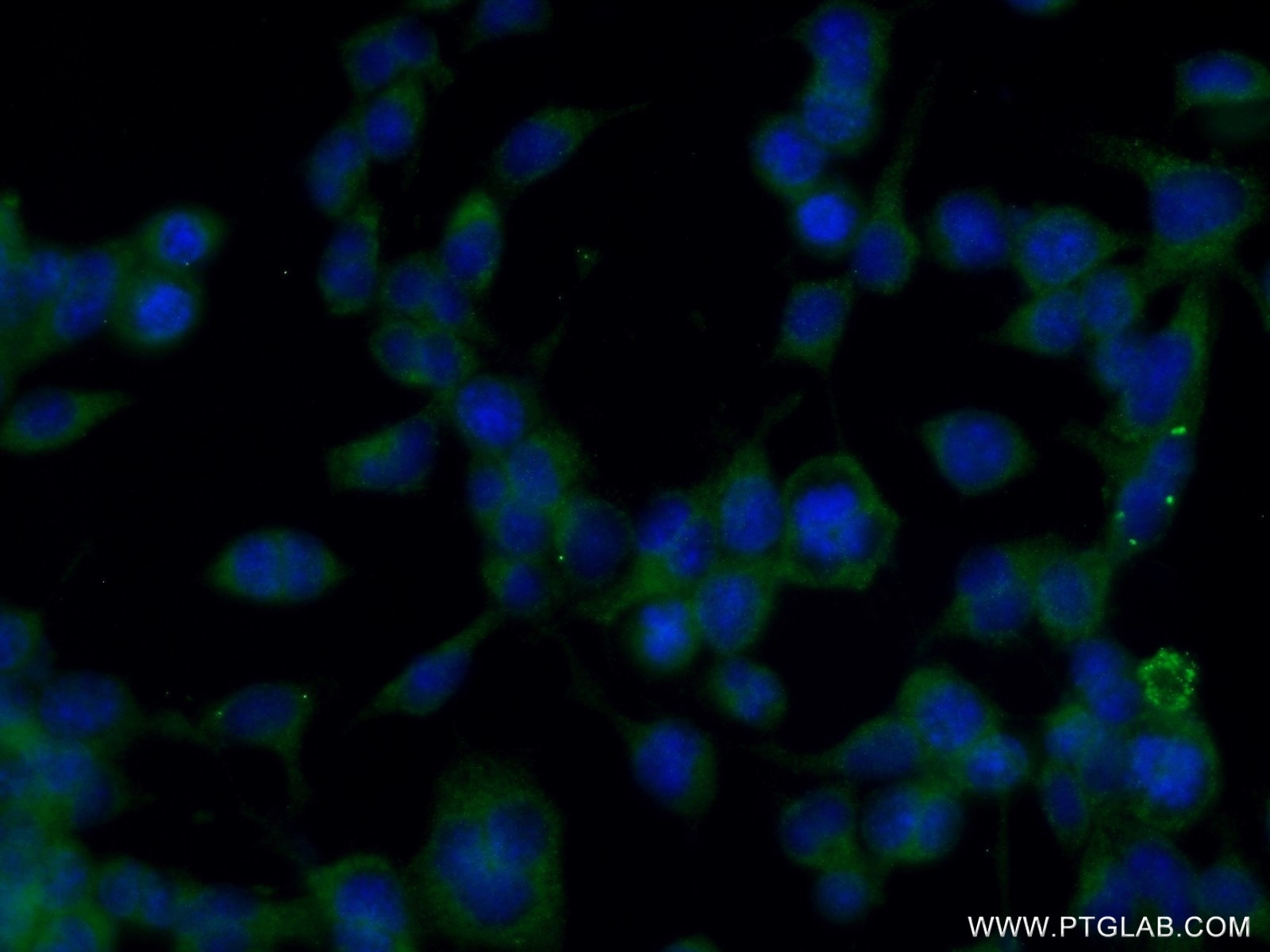 Immunofluorescence (IF) / fluorescent staining of Neuro-2a cells using SHD Polyclonal antibody (20814-1-AP)