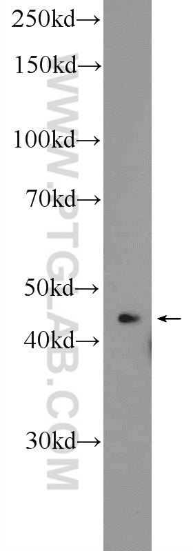 Western Blot (WB) analysis of SMMC-7721 cells using SHD Polyclonal antibody (20814-1-AP)