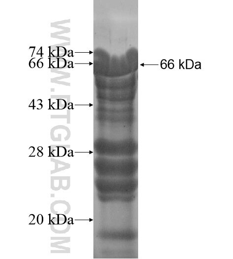 SHD fusion protein Ag14794 SDS-PAGE