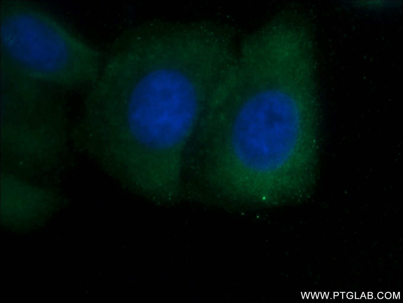 Immunofluorescence (IF) / fluorescent staining of HepG2 cells using SHE Polyclonal antibody (22902-1-AP)