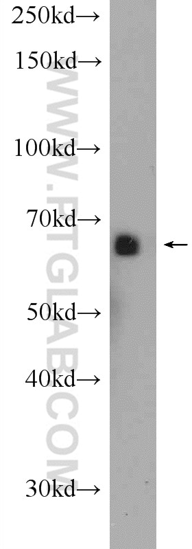 Western Blot (WB) analysis of mouse testis tissue using SHE Polyclonal antibody (22902-1-AP)