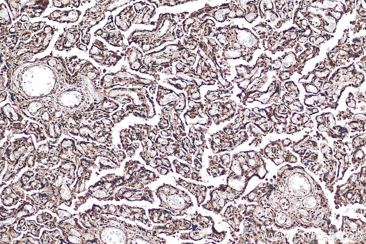 Immunohistochemistry (IHC) staining of human placenta tissue using DSS1 Polyclonal antibody (13639-1-AP)