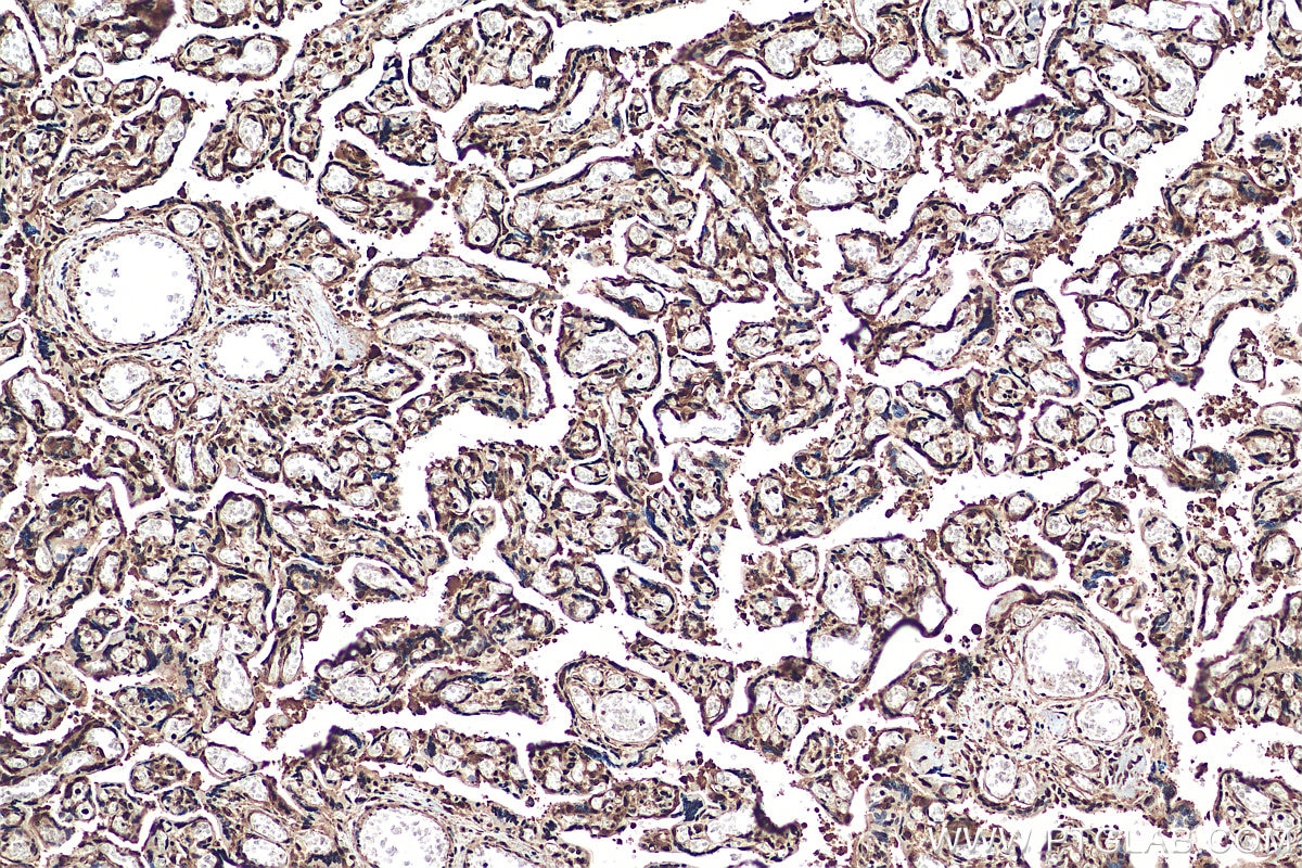 IHC staining of human placenta using 13639-1-AP