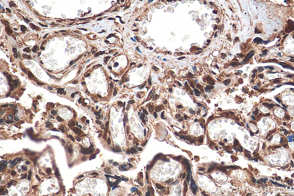 Immunohistochemistry (IHC) staining of human placenta tissue using DSS1 Polyclonal antibody (13639-1-AP)