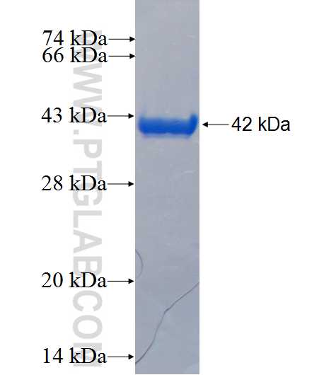 SHFM1 fusion protein Ag4573 SDS-PAGE