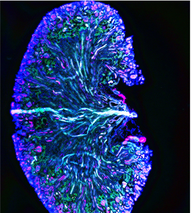 Immunofluorescence (IF) / fluorescent staining of mouse kidney tissue using SHH Polyclonal antibody (20697-1-AP)