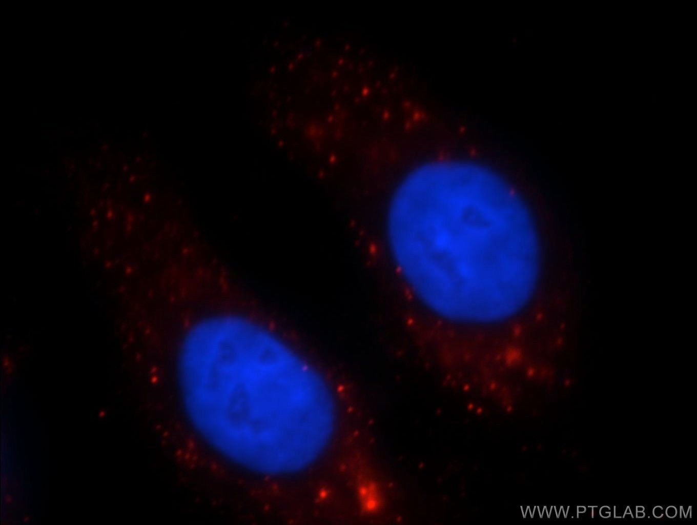 Immunofluorescence (IF) / fluorescent staining of HepG2 cells using SHH Polyclonal antibody (20697-1-AP)