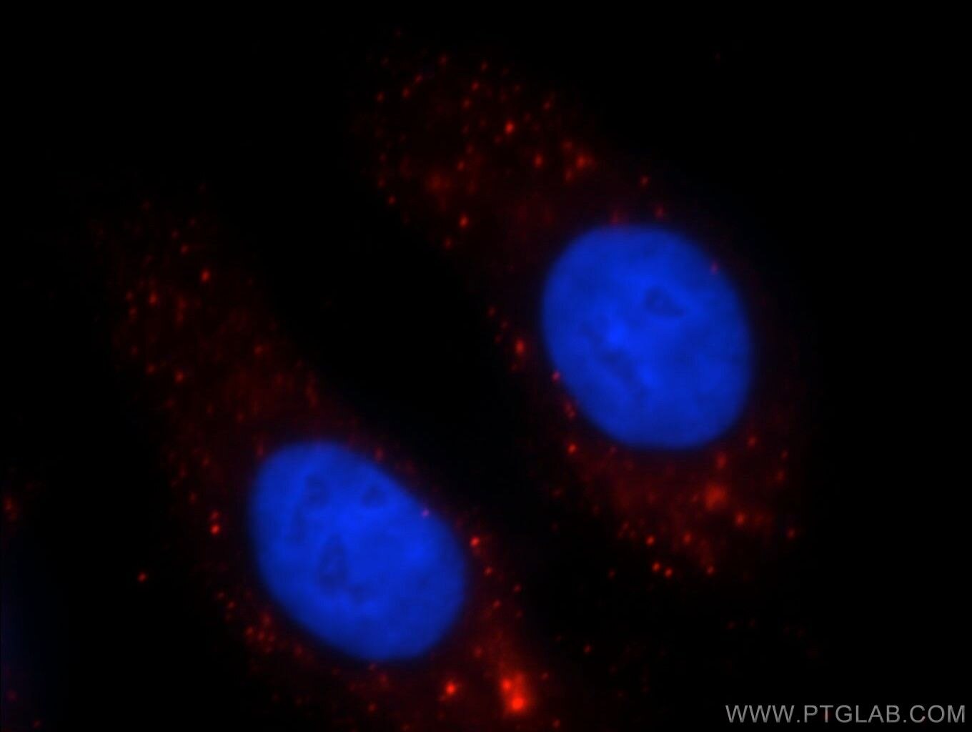 IF Staining of HepG2 using 20697-1-AP