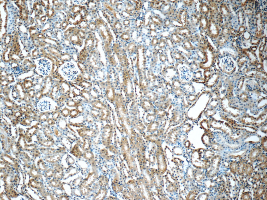 Immunohistochemistry (IHC) staining of mouse kidney tissue using SHH Polyclonal antibody (20697-1-AP)