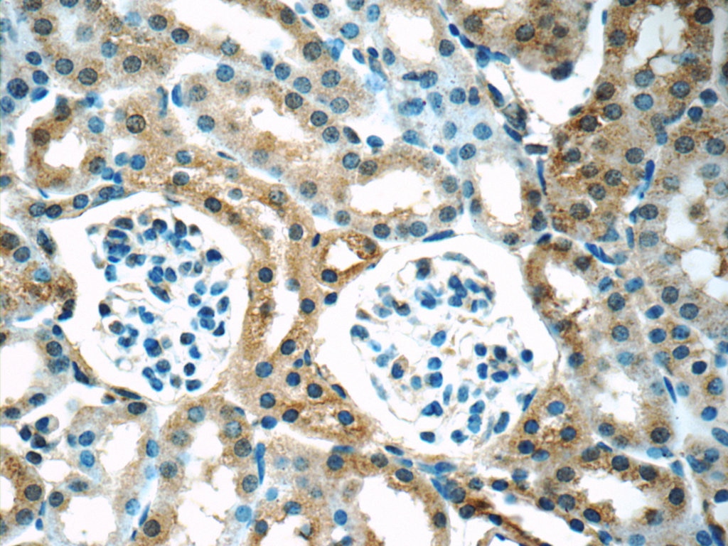 Immunohistochemistry (IHC) staining of mouse kidney tissue using SHH Polyclonal antibody (20697-1-AP)