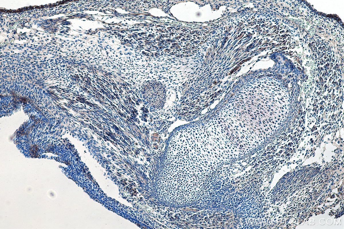 Immunohistochemistry (IHC) staining of mouse embryo tissue using SHH Polyclonal antibody (20697-1-AP)