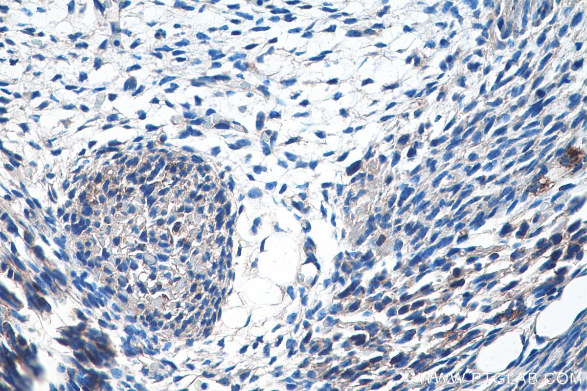 Immunohistochemistry (IHC) staining of mouse embryo tissue using SHH Polyclonal antibody (20697-1-AP)