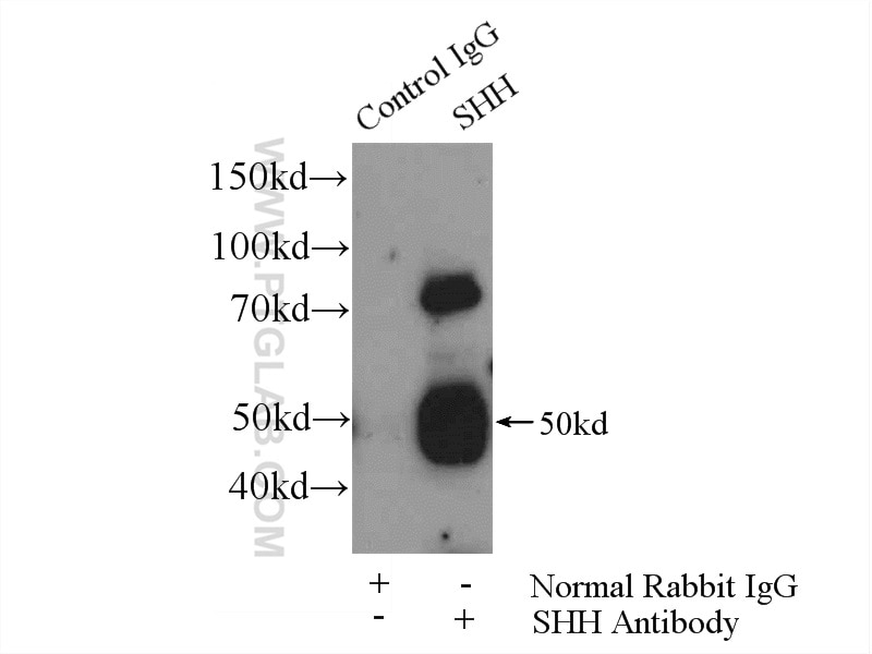 Immunoprecipitation (IP) experiment of mouse liver tissue using SHH Polyclonal antibody (20697-1-AP)