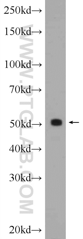 Western Blot (WB) analysis of rat kidney tissue using SHH Polyclonal antibody (20697-1-AP)
