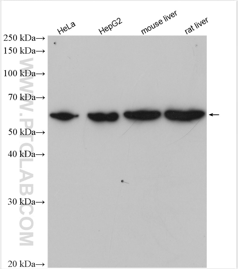 Western Blot (WB) analysis of various lysates using SHH Polyclonal antibody (20697-1-AP)