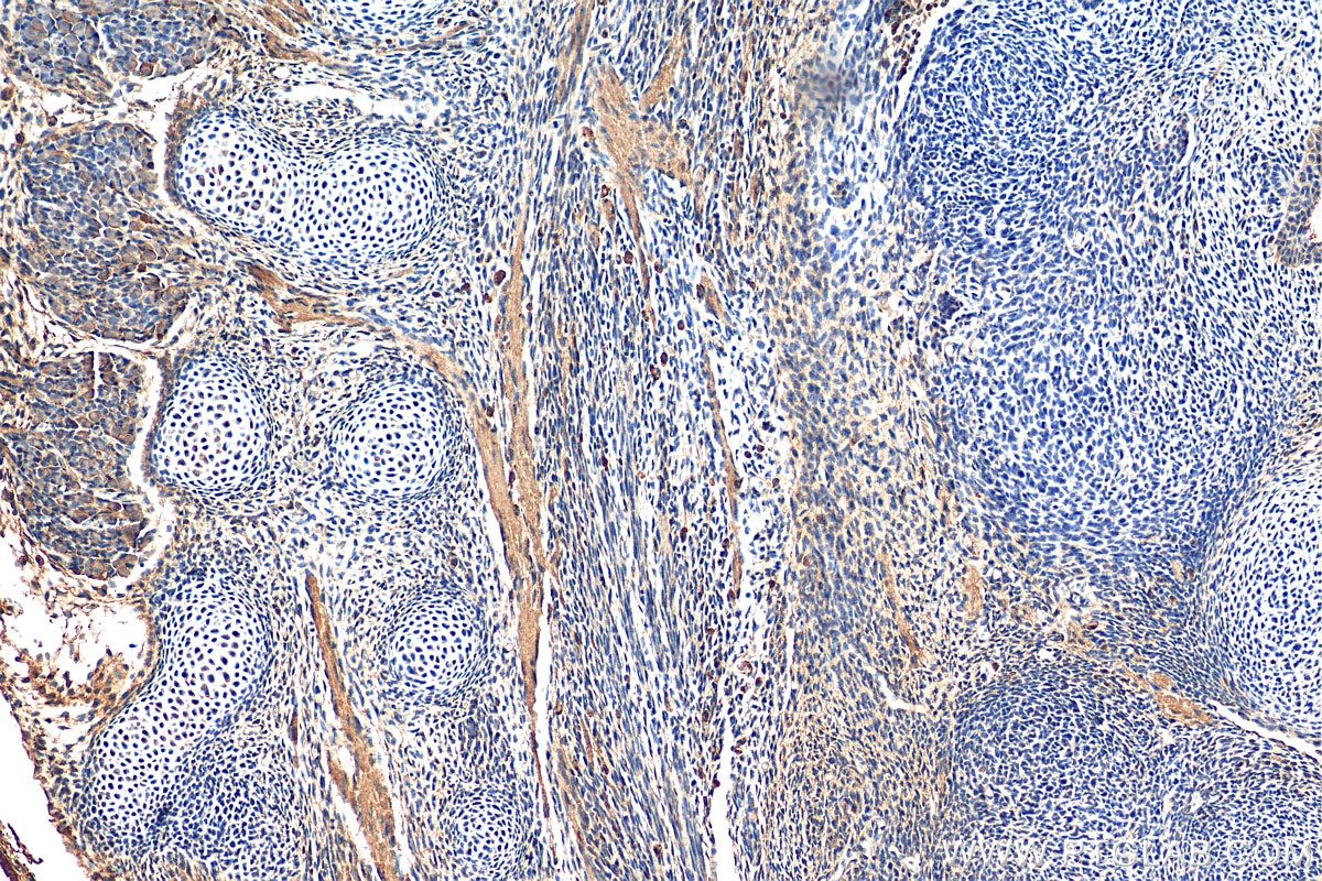 Immunohistochemistry (IHC) staining of mouse embryo tissue using SHH Polyclonal antibody (29752-1-AP)
