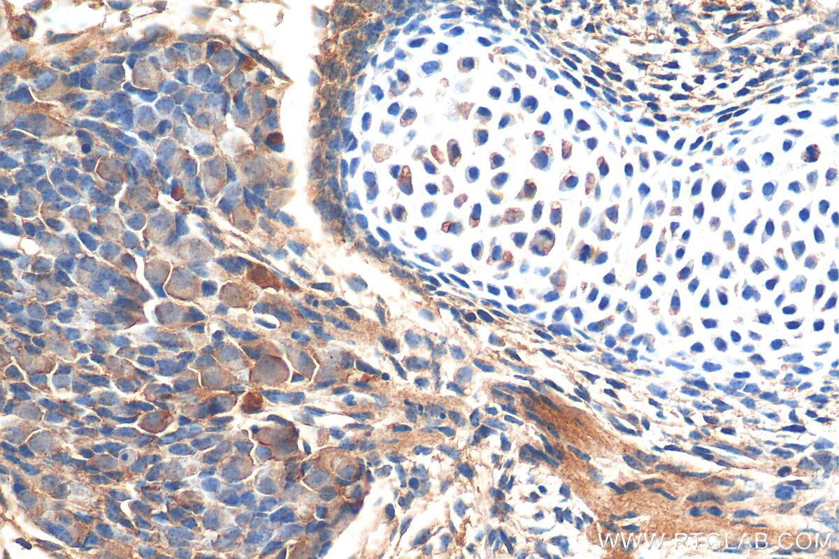 IHC staining of mouse embryo using 29752-1-AP