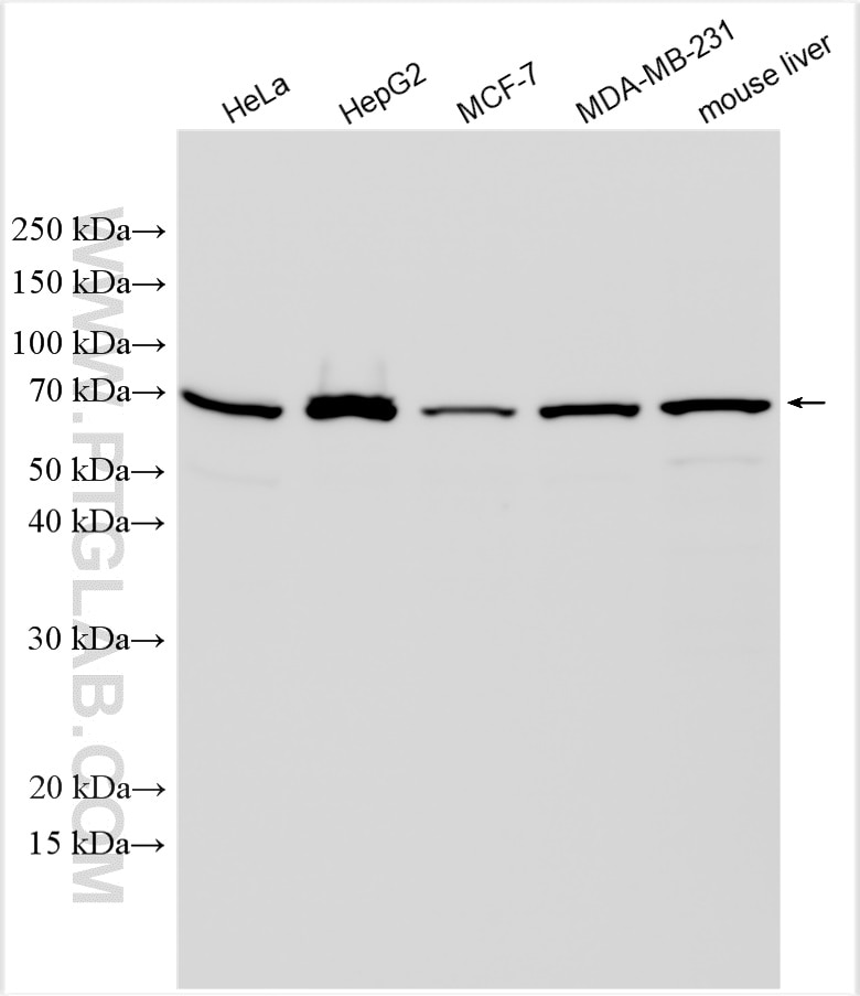 Western Blot (WB) analysis of various lysates using SHH Polyclonal antibody (29752-1-AP)
