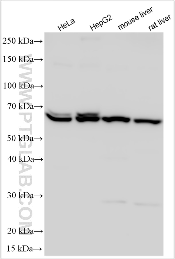 Western Blot (WB) analysis of various lysates using SHH Polyclonal antibody (29752-1-AP)