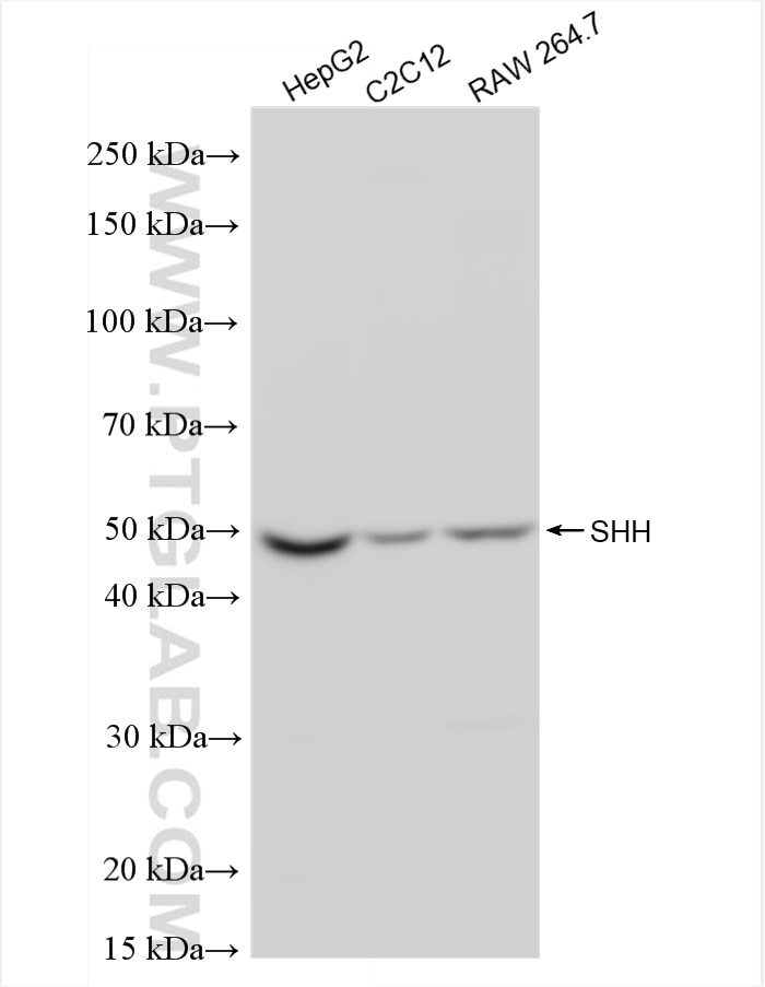 Western Blot (WB) analysis of various lysates using SHH Recombinant antibody (83280-2-RR)