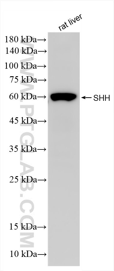 Western Blot (WB) analysis of rat liver tissue using SHH Recombinant antibody (86106-1-RR)