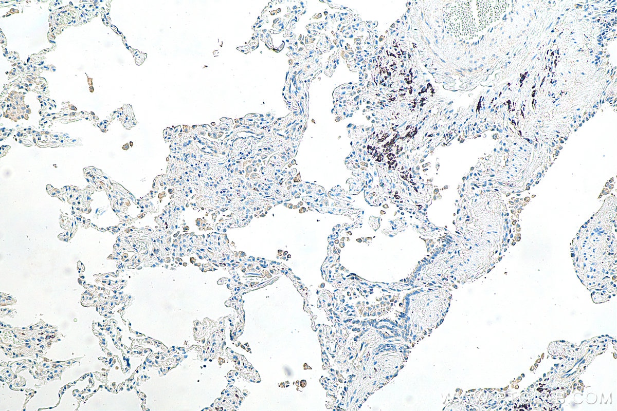 IHC staining of human lung using 30240-1-AP