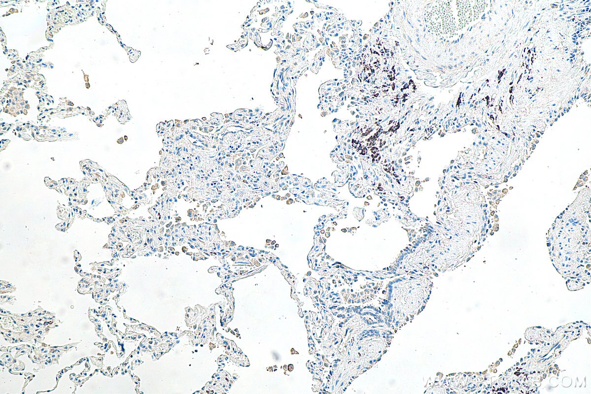 Immunohistochemistry (IHC) staining of human lung tissue using SHISA8 Polyclonal antibody (30240-1-AP)