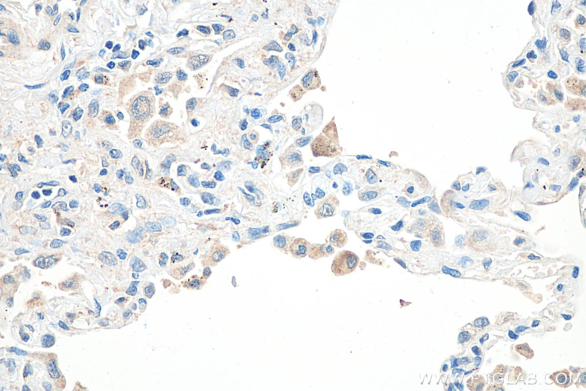Immunohistochemistry (IHC) staining of human lung tissue using SHISA8 Polyclonal antibody (30240-1-AP)