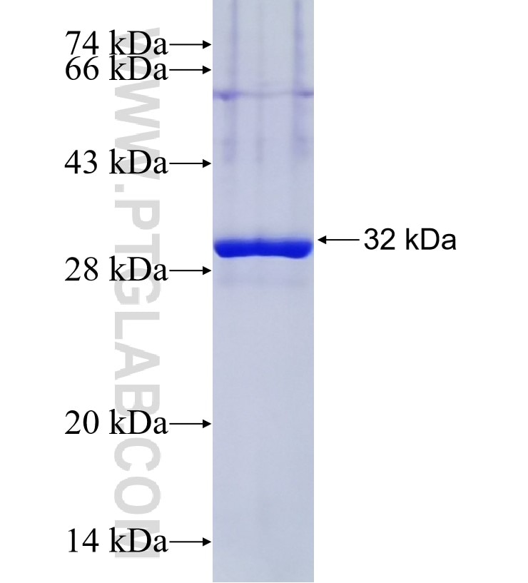 SHISA9 fusion protein Ag34681 SDS-PAGE SHISA9 fusion protein Ag34681 SDS-PAGE